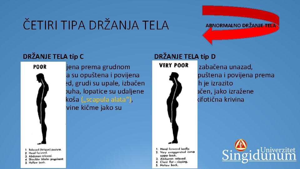 ČETIRI TIPA DRŽANJA TELA DRŽANJE TELA tip C § glava je povijena prema grudnom