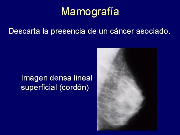 Mamografía Descarta la presencia de un cáncer asociado. Imagen densa lineal superficial (cordón) 