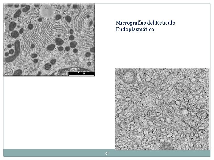 Micrografías del Retículo Endoplasmático 30 