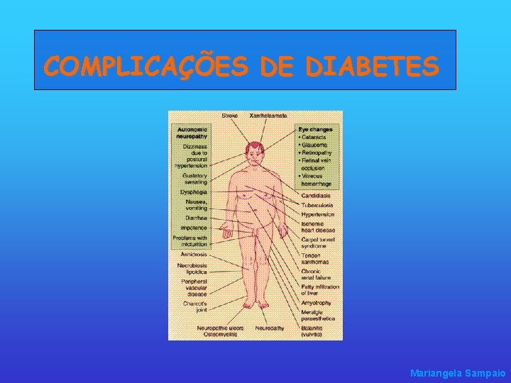 COMPLICAÇÕES DE DIABETES Mariangela Sampaio 