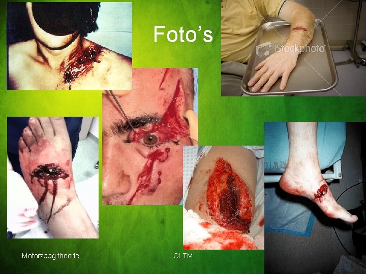 Foto’s Motorzaag theorie GLTM 