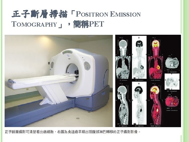 正子斷層掃描「POSITRON EMISSION TOMOGRAPHY」，簡稱PET 