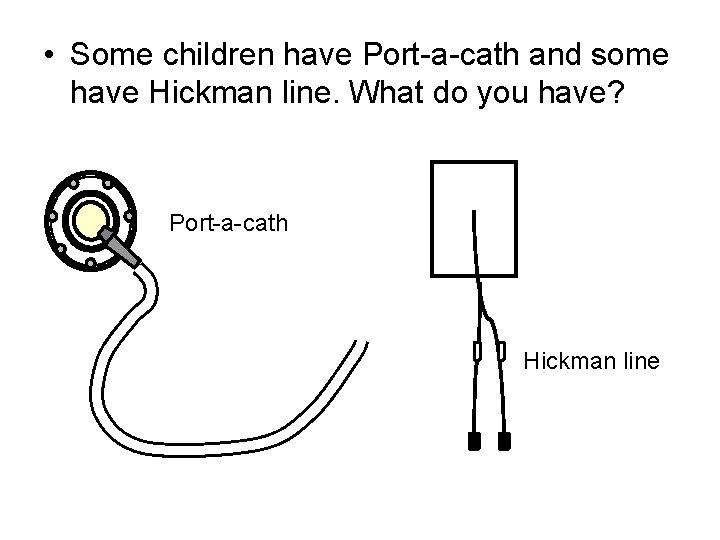  • Some children have Port-a-cath and some have Hickman line. What do you