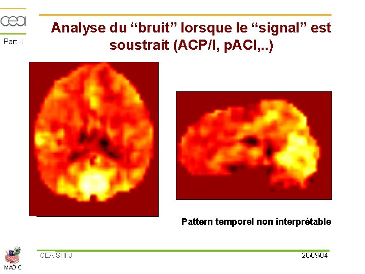 Part II Analyse du “bruit” lorsque le “signal” est soustrait (ACP/I, p. ACI, .
