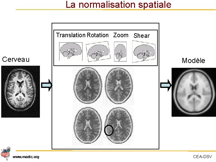 La normalisation spatiale Translation Rotation Zoom Shear Cerveau www. madic. org Modèle CEA-DSV 