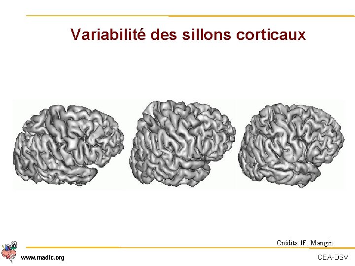 Variabilité des sillons corticaux Crédits JF. Mangin www. madic. org CEA-DSV 