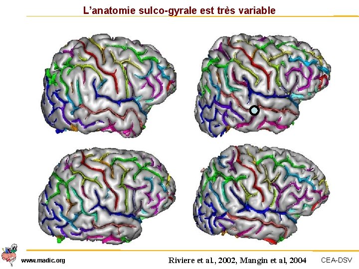 L’anatomie sulco-gyrale est très variable www. madic. org Riviere et al. , 2002, Mangin