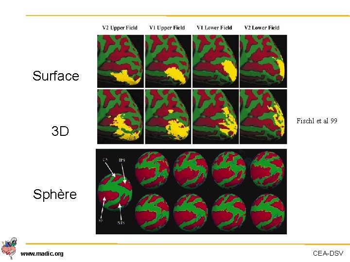 Surface 3 D Fischl et al 99 Sphère www. madic. org CEA-DSV 