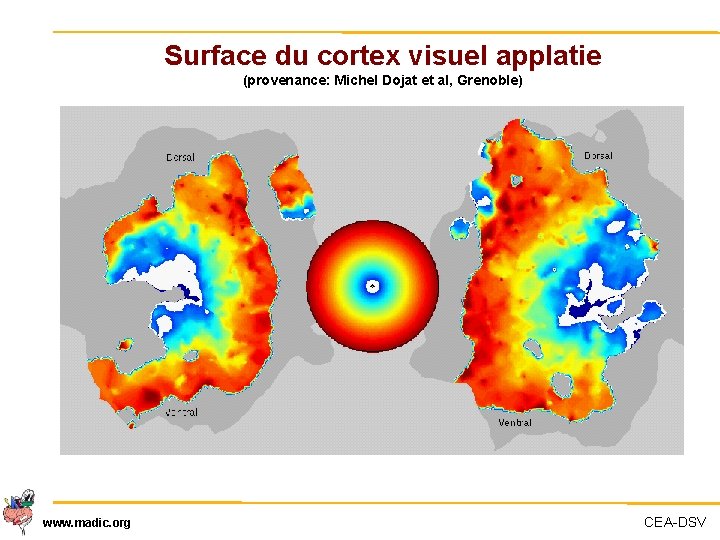 Surface du cortex visuel applatie (provenance: Michel Dojat et al, Grenoble) www. madic. org