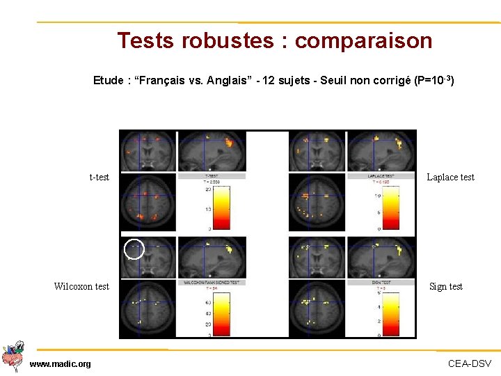 Tests robustes : comparaison Etude : “Français vs. Anglais” - 12 sujets - Seuil