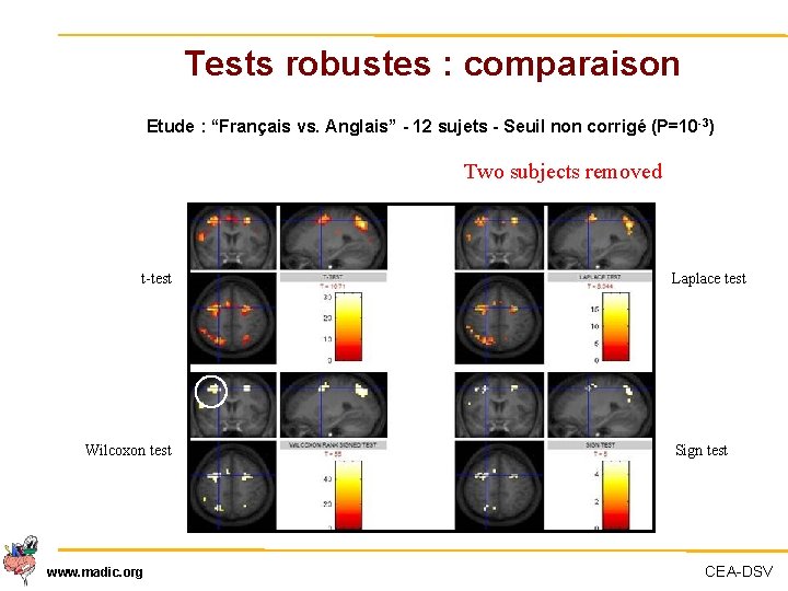 Tests robustes : comparaison Etude : “Français vs. Anglais” - 12 sujets - Seuil