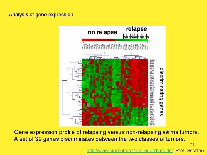 Analysis of gene expression Gene expression profile of relapsing versus non-relapsing Wilms tumors. A