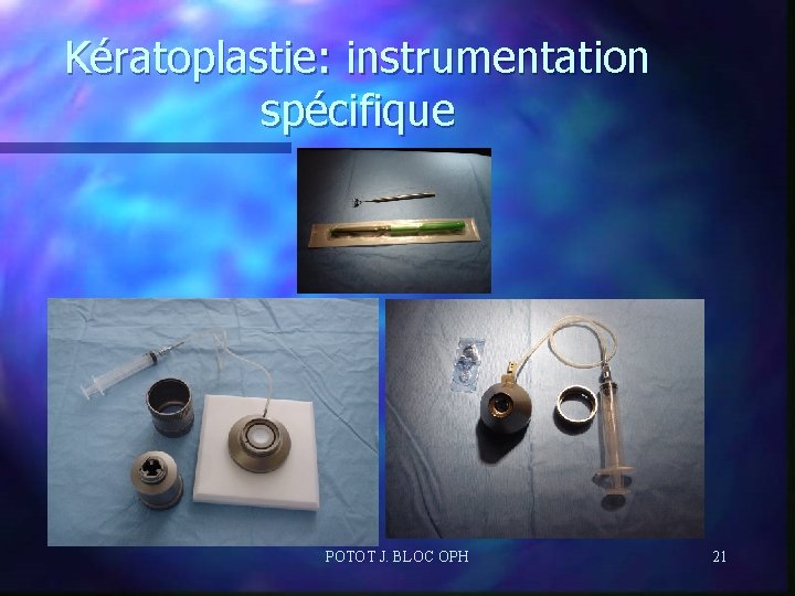 Kératoplastie: instrumentation spécifique POTOT J. BLOC OPH 21 