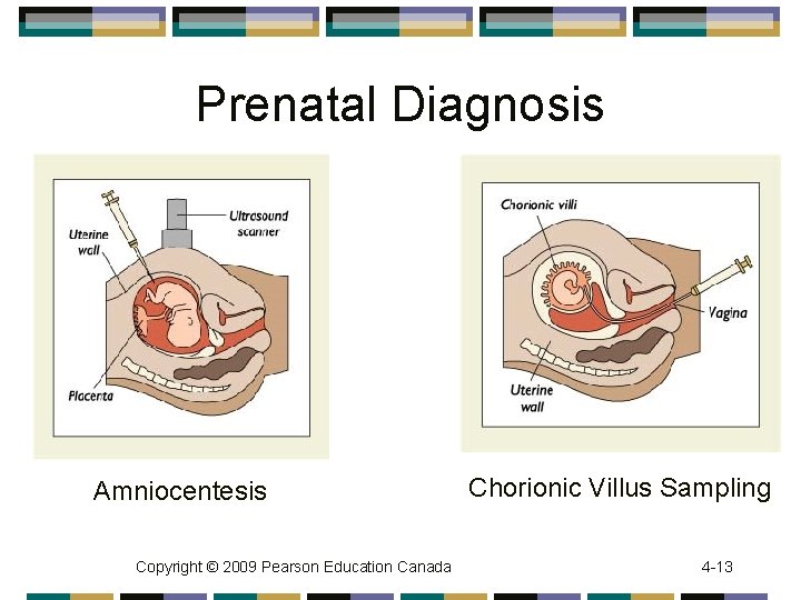 Prenatal Diagnosis Amniocentesis Copyright © 2009 Pearson Education Canada Chorionic Villus Sampling 4 -13