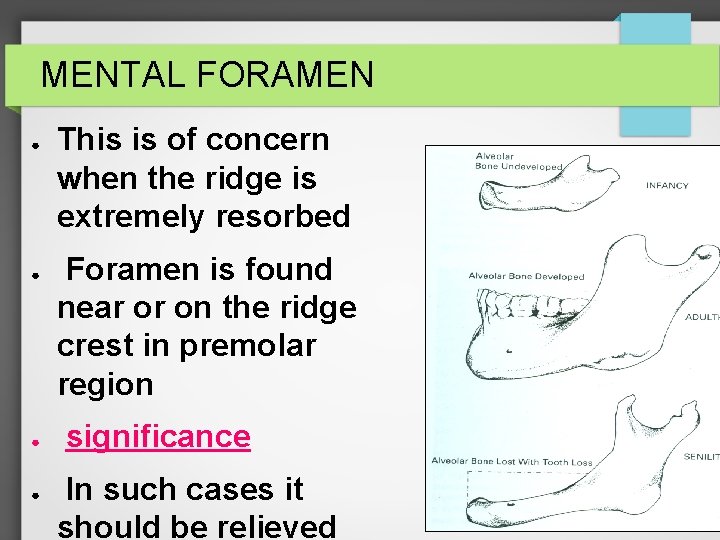 MENTAL FORAMEN ● ● This is of concern when the ridge is extremely resorbed