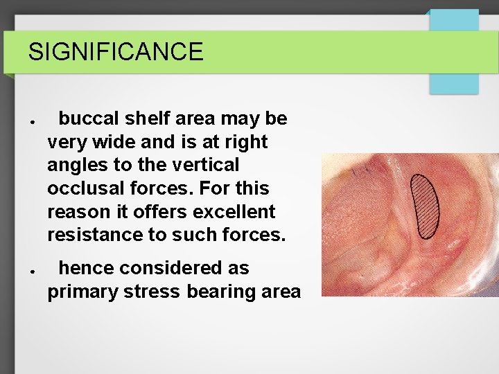 SIGNIFICANCE ● ● buccal shelf area may be very wide and is at right