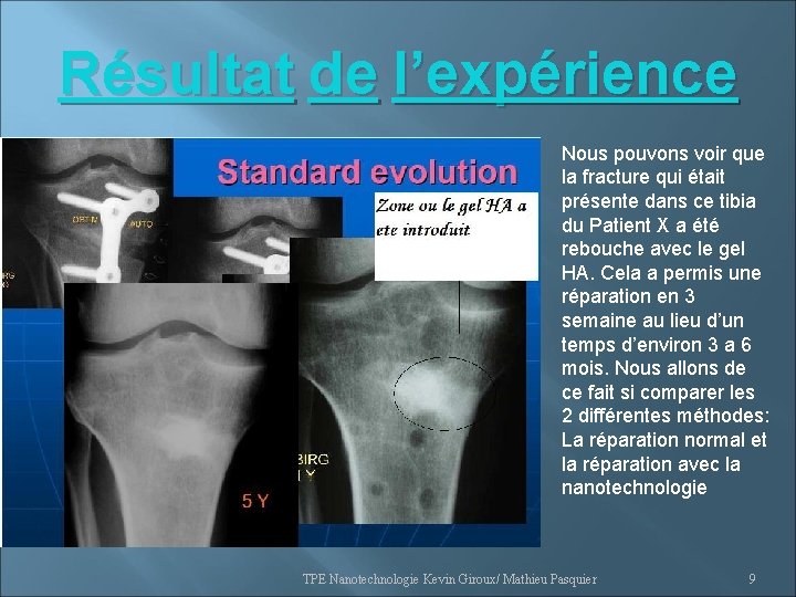 Résultat de l’expérience Nous pouvons voir que la fracture qui était présente dans ce