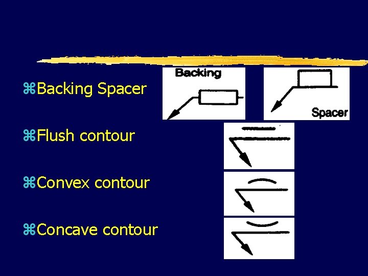 z. Backing Spacer z. Flush contour z. Convex contour z. Concave contour 