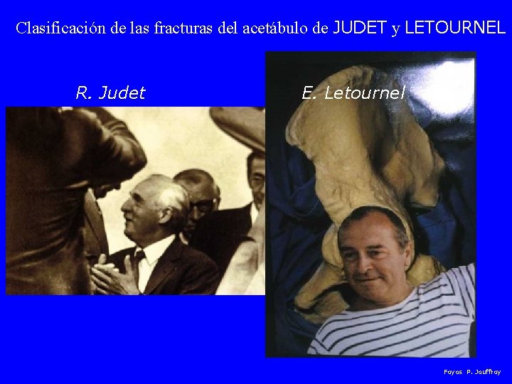 Clasificación de las fracturas del acetábulo de JUDET y LETOURNEL R. Judet E. Letournel