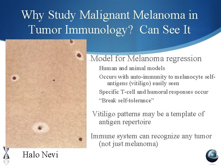 Why Study Malignant Melanoma in Tumor Immunology? Can See It Model for Melanoma regression