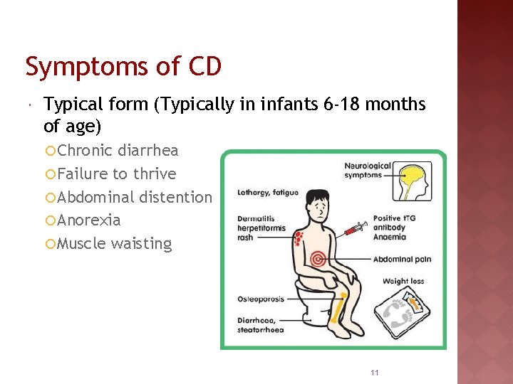 Symptoms of CD Typical form (Typically in infants 6 -18 months of age) ¡