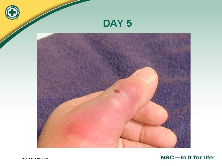 DAY 5 © 2011 National Safety Council 