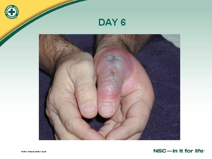 DAY 6 © 2011 National Safety Council 