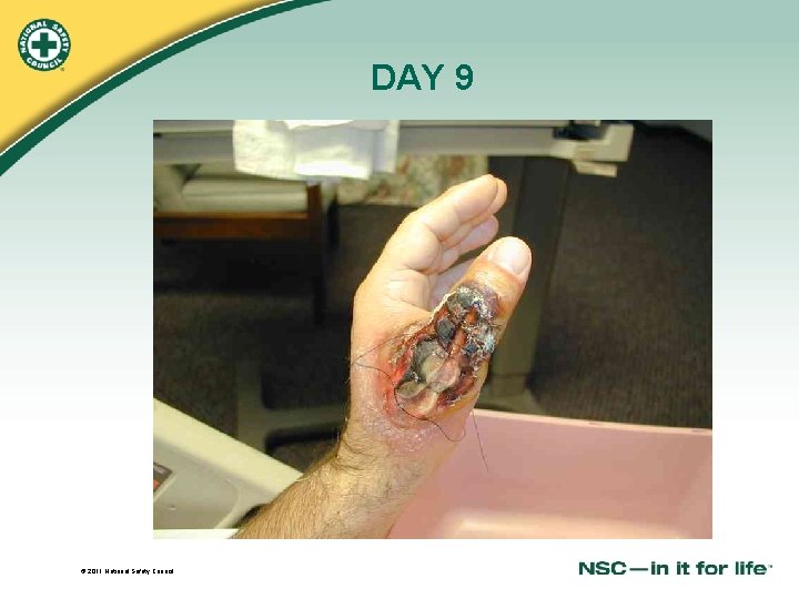 DAY 9 © 2011 National Safety Council 