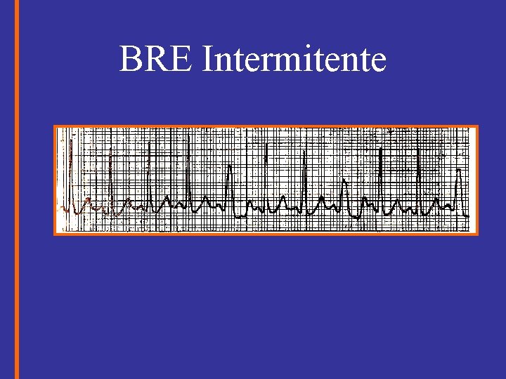 BRE Intermitente 