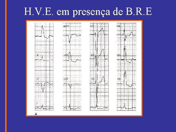 H. V. E. em presença de B. R. E 