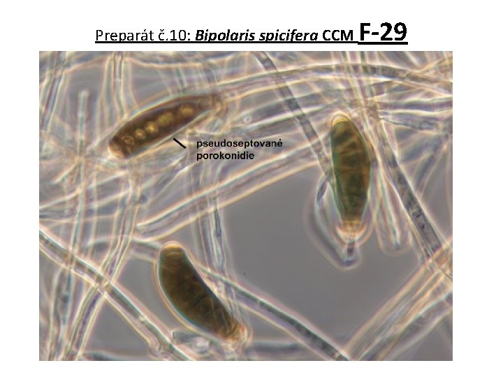 Preparát č. 10: Bipolaris spicifera CCM F-29 
