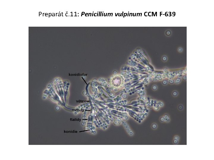 Preparát č. 11: Penicillium vulpinum CCM F-639 