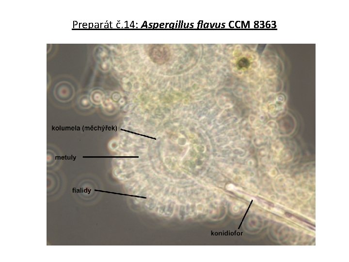 Preparát č. 14: Aspergillus flavus CCM 8363 