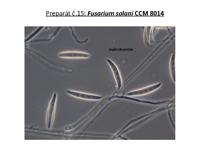 Preparát č. 15: Fusarium solani CCM 8014 