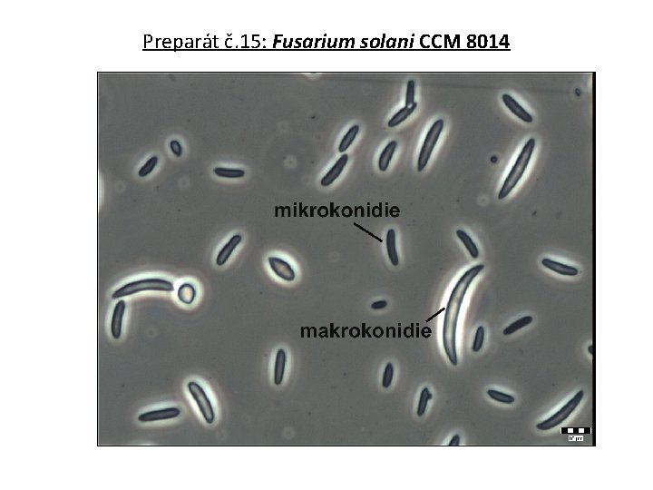 Preparát č. 15: Fusarium solani CCM 8014 