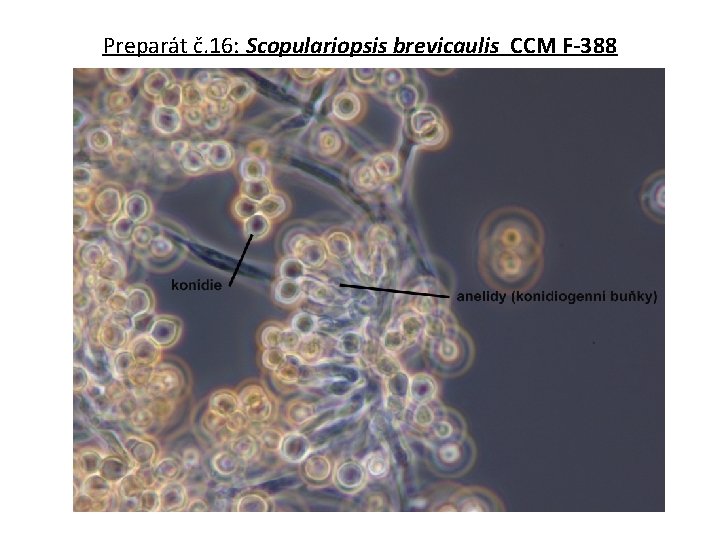 Preparát č. 16: Scopulariopsis brevicaulis CCM F-388 