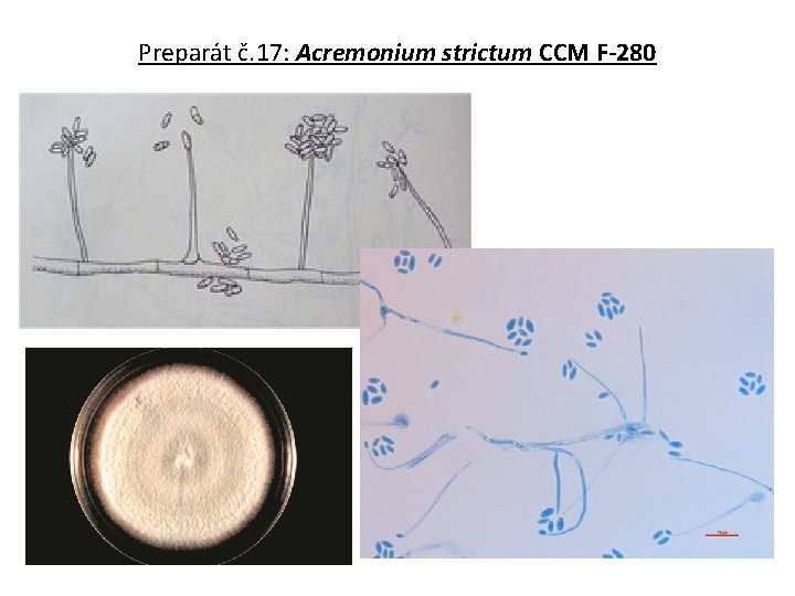 Preparát č. 17: Acremonium strictum CCM F-280 
