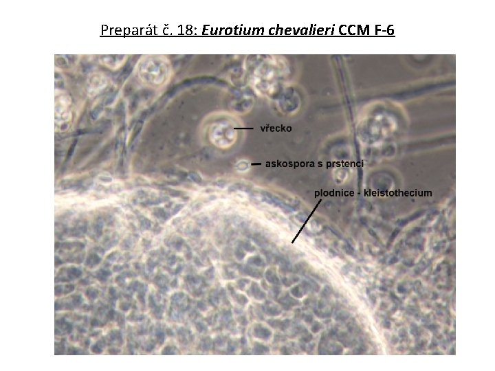 Preparát č. 18: Eurotium chevalieri CCM F-6 