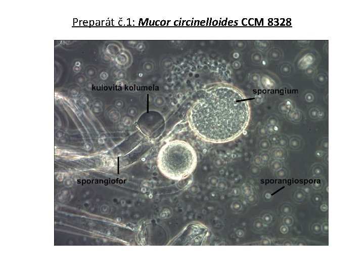 Preparát č. 1: Mucor circinelloides CCM 8328 