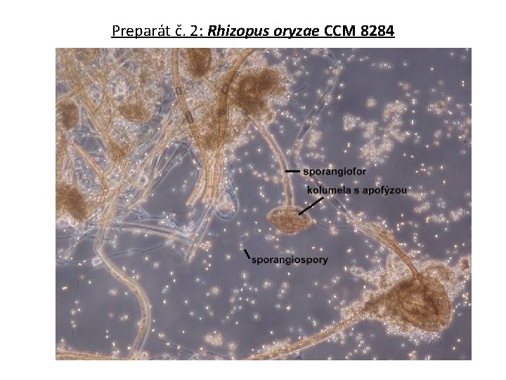 Preparát č. 2: Rhizopus oryzae CCM 8284 