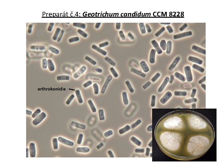 Preparát č. 4: Geotrichum candidum CCM 8228 