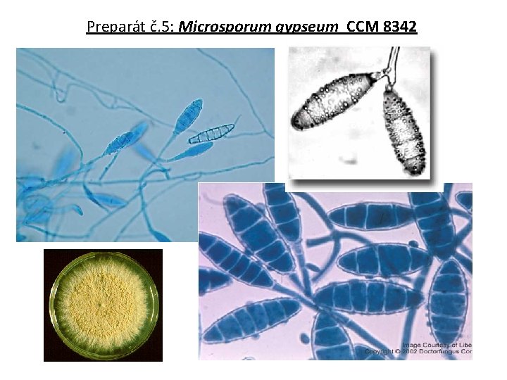 Preparát č. 5: Microsporum gypseum CCM 8342 