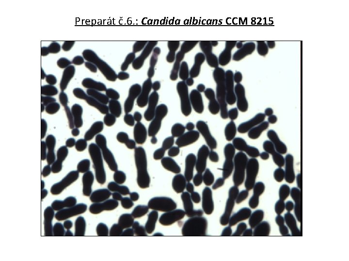 Preparát č. 6. : Candida albicans CCM 8215 