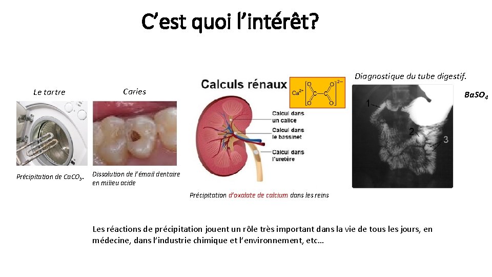C’est quoi l’intérêt? Diagnostique du tube digestif. Le tartre Caries Précipitation de Ca. CO