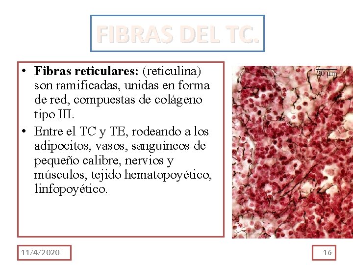 FIBRAS DEL TC. • Fibras reticulares: (reticulina) son ramificadas, unidas en forma de red, FIBRAS DEL TC. • Fibras reticulares: (reticulina) son ramificadas, unidas en forma de red,