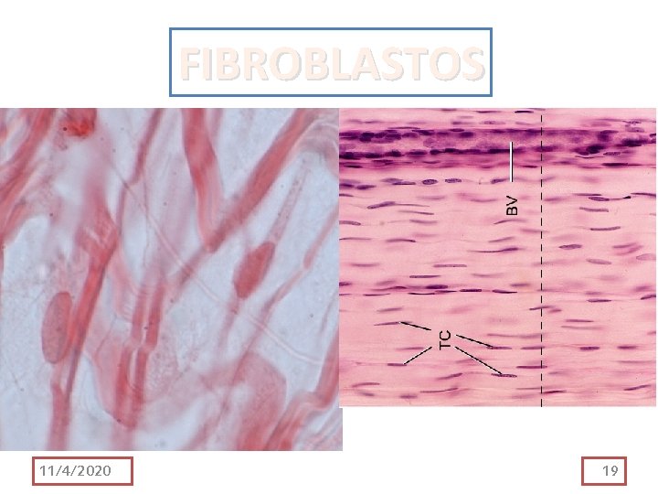 FIBROBLASTOS 11/4/2020 19 FIBROBLASTOS 11/4/2020 19