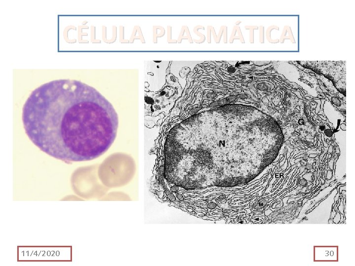 CÉLULA PLASMÁTICA 11/4/2020 30 CÉLULA PLASMÁTICA 11/4/2020 30