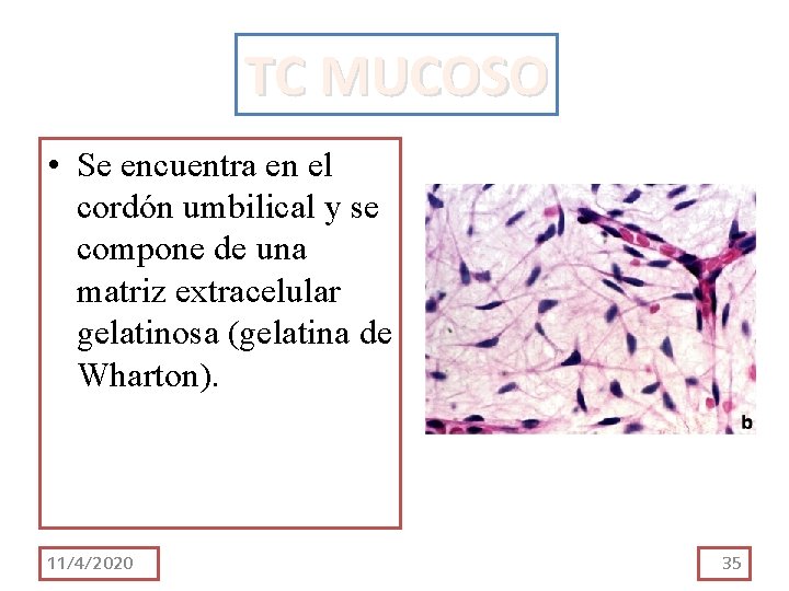TC MUCOSO • Se encuentra en el cordón umbilical y se compone de una TC MUCOSO • Se encuentra en el cordón umbilical y se compone de una