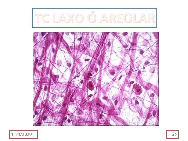 TC LAXO Ó AREOLAR 11/4/2020 36 TC LAXO Ó AREOLAR 11/4/2020 36