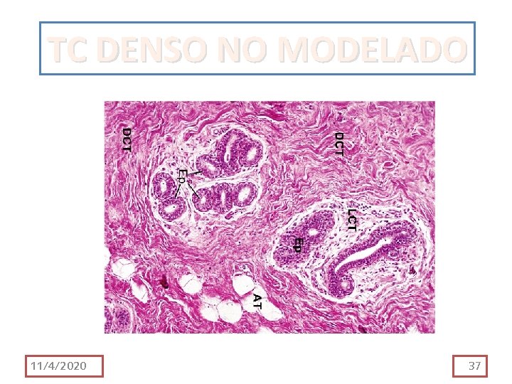 TC DENSO NO MODELADO 11/4/2020 37 TC DENSO NO MODELADO 11/4/2020 37